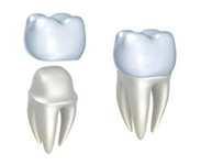 crowns
