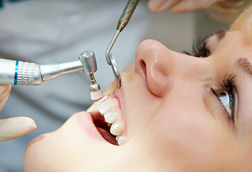 Dental Cleaning