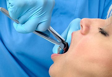 Extractions